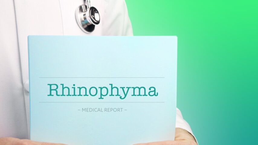 Doctor holds documents in his hands about rhinophyma