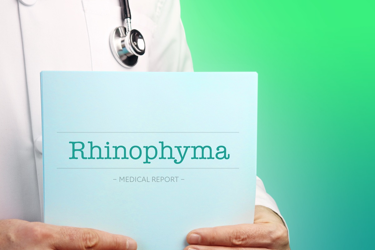 Doctor holds documents in his hands about rhinophyma